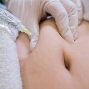 Fat dissolving Injections course CPD Course - Call 01908 310372 for avalibility